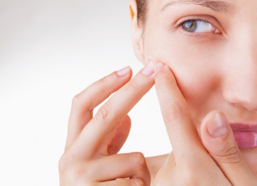 brufoli, rimedi naturali, acne viso