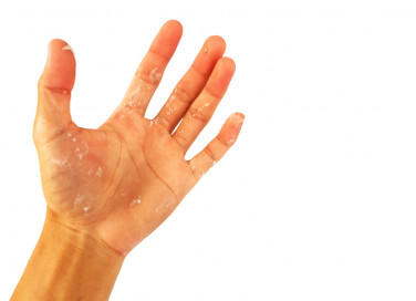come togliere silicone mani, come pulire silicone mani, togliere silicone pelle
