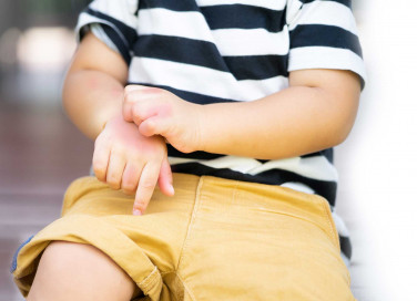 Zanzare vettori di malattie