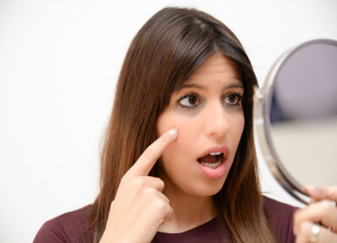 rimedi naturali occhiaie, come schiarirle, sgonfiarle