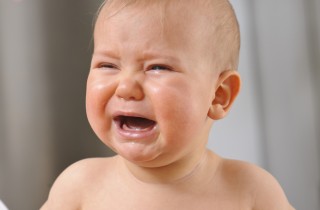 Affrontare ustioni e scottature