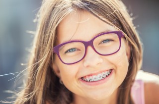 Apparecchio denti per bambini: quando e in quali casi metterlo