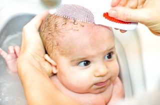 Crosta lattea nei neonati, quali sono i rimedi naturali?