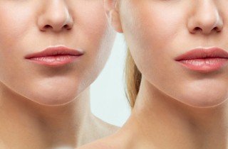 Come truccare le labbra sottili