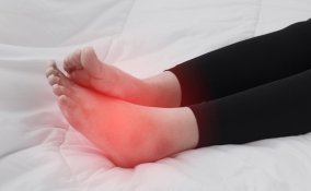 caviglie gonfie, rimedi naturali, erboristeria