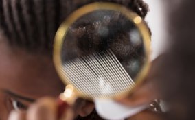 eliminare pidocchi capelli molto ricci, eliminare pidocchi capelli ricci