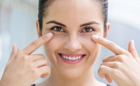 borse sotto occhi, rimedi naturali, viso donna