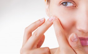 brufoli, rimedi naturali, acne viso