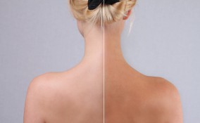 abbronzatura spray, quanto dura, costi