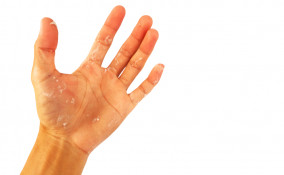 come togliere silicone mani, come pulire silicone mani, togliere silicone pelle