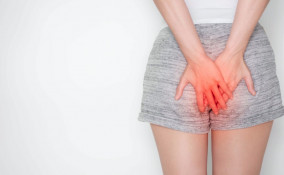 ragadi esterne, rimedi naturali, soluzioni