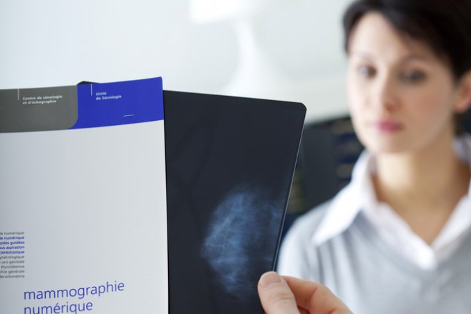 seno salute prevenzione