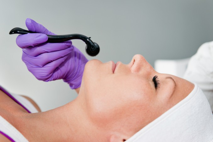 derma-rolling