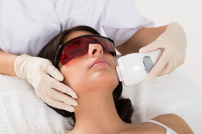 epilazione laser