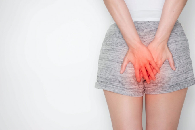 ragadi esterne, rimedi naturali, soluzioni