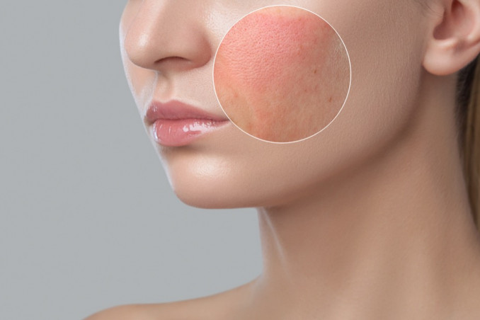 trucco, dermatite, consigli