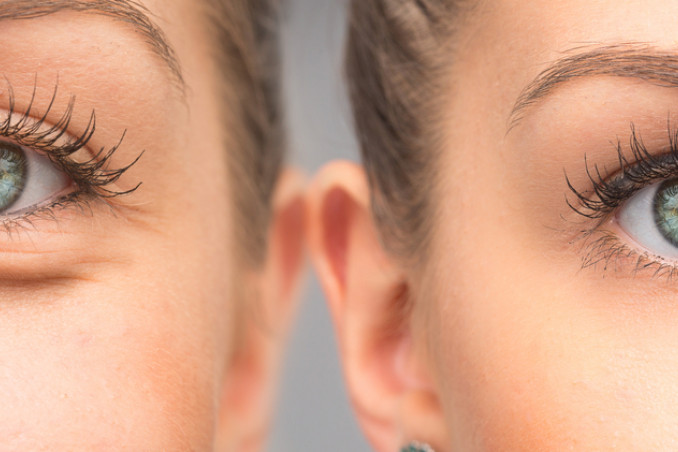 Borse sotto gli occhi